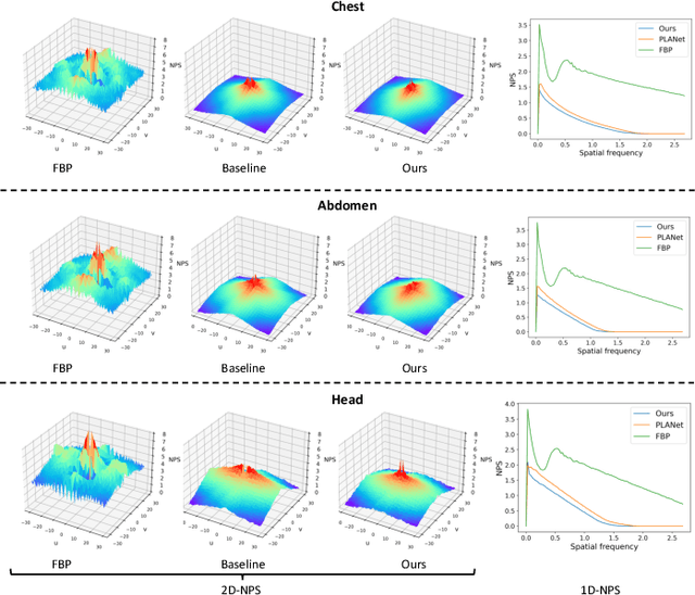 Figure 2 for Learning Task-Specific Sampling Strategy for Sparse-View CT Reconstruction