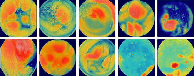 Figure 4 for Transformer-Based Wireless Capsule Endoscopy Bleeding Tissue Detection and Classification