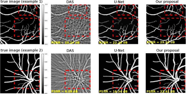 Figure 4 for Using Spatial Diffusions for Optoacoustic Tomography Image Reconstruction