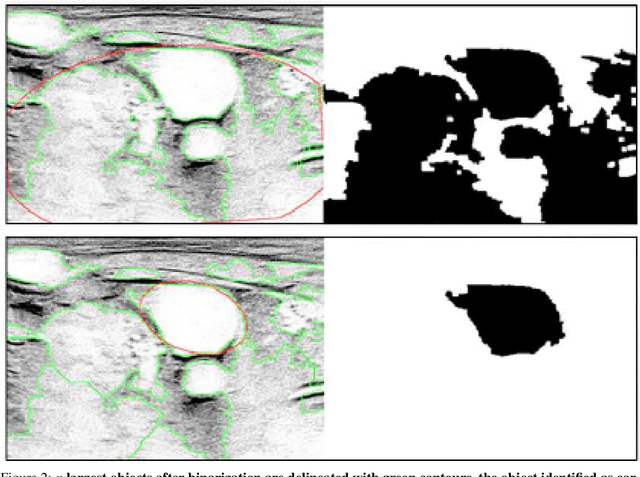 Figure 2 for Impact of PCA-based preprocessing and different CNN structures on deformable registration of sonograms