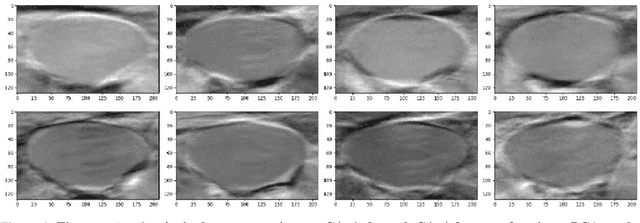 Figure 4 for Impact of PCA-based preprocessing and different CNN structures on deformable registration of sonograms