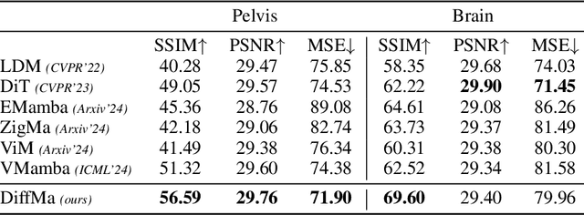 Figure 4 for Soft Masked Mamba Diffusion Model for CT to MRI Conversion