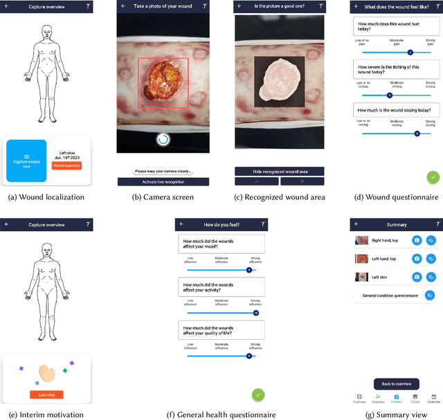 Figure 3 for WoundAIssist: A Patient-Centered Mobile App for AI-Assisted Wound Care With Physicians in the Loop