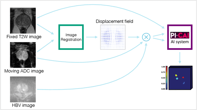 Figure 1 for Deformable MRI Sequence Registration for AI-based Prostate Cancer Diagnosis