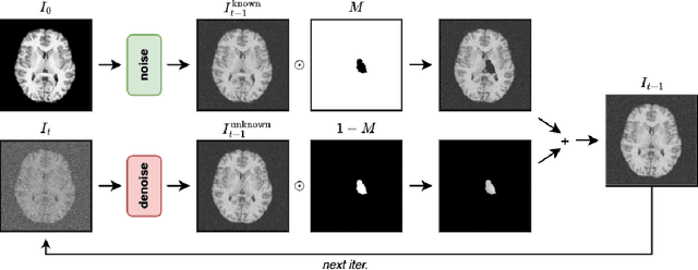 Figure 1 for Investigating the Role of Bilateral Symmetry for Inpainting Brain MRI