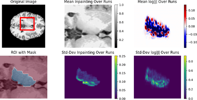 Figure 2 for Investigating the Role of Bilateral Symmetry for Inpainting Brain MRI