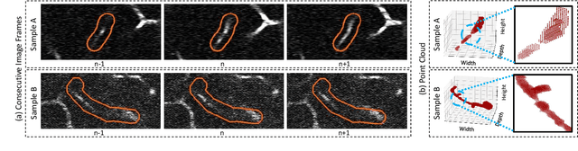 Figure 1 for A Sequence Agnostic Multimodal Preprocessing for Clogged Blood Vessel Detection in Alzheimer's Diagnosis