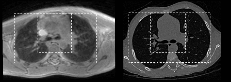 Figure 1 for Deformation-aware GAN for Medical Image Synthesis with Substantially Misaligned Pairs