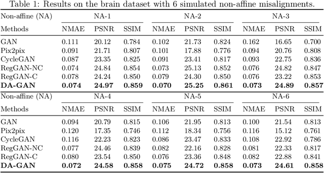 Figure 2 for Deformation-aware GAN for Medical Image Synthesis with Substantially Misaligned Pairs