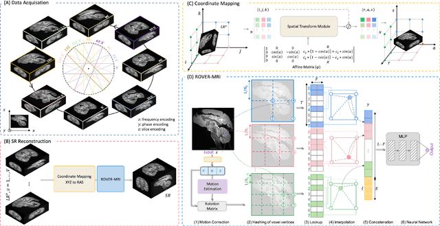 Figure 1 for Rapid Whole Brain Mesoscale In-vivo MR Imaging using Multi-scale Implicit Neural Representation
