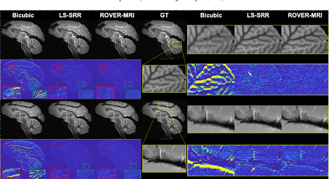 Figure 3 for Rapid Whole Brain Mesoscale In-vivo MR Imaging using Multi-scale Implicit Neural Representation