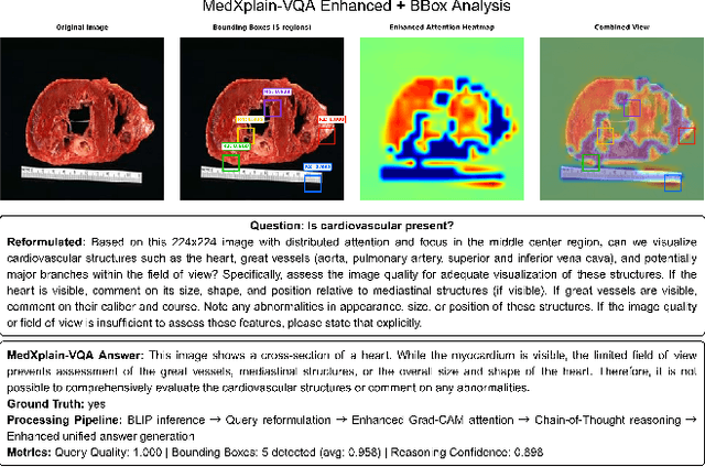 Figure 4 for MedXplain-VQA: Multi-Component Explainable Medical Visual Question Answering