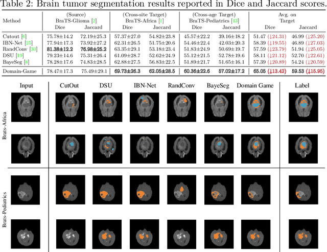 Figure 3 for Domain Game: Disentangle Anatomical Feature for Single Domain Generalized Segmentation