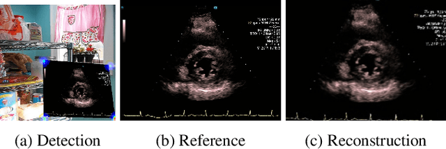 Figure 3 for Self-Supervised Ultrasound Screen Detection