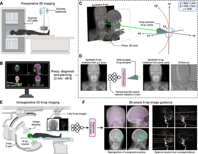Figure 1 for Rapid patient-specific neural networks for intraoperative X-ray to volume registration