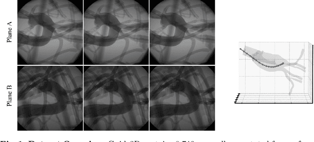Figure 1 for Guide3D: A Bi-planar X-ray Dataset for 3D Shape Reconstruction