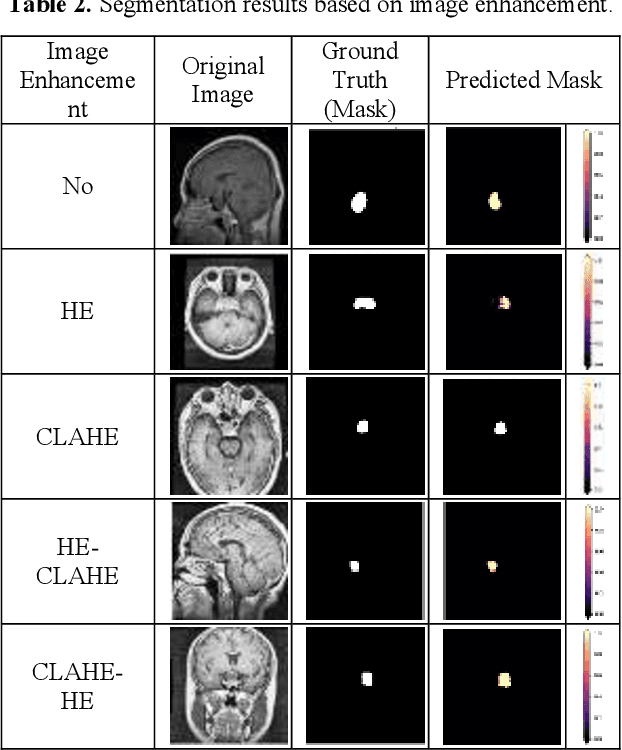 Figure 4 for Comparative Analysis of Image Enhancement Techniques for Brain Tumor Segmentation: Contrast, Histogram, and Hybrid Approaches