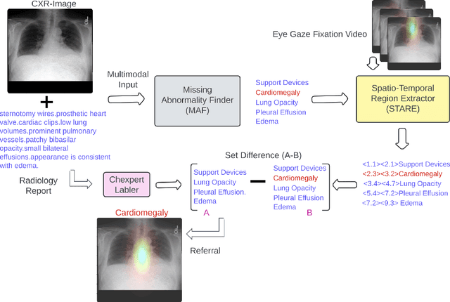 Figure 3 for Enhancing Radiological Diagnosis: A Collaborative Approach Integrating AI and Human Expertise for Visual Miss Correction