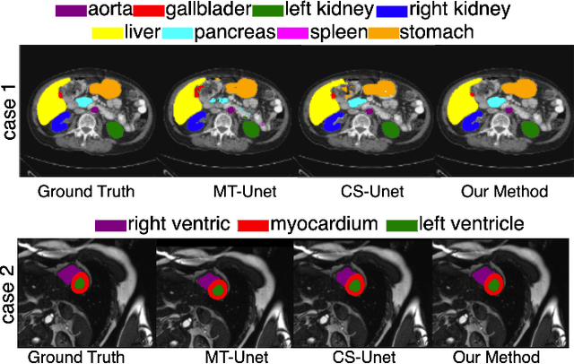 Figure 2 for GLoG-CSUnet: Enhancing Vision Transformers with Adaptable Radiomic Features for Medical Image Segmentation
