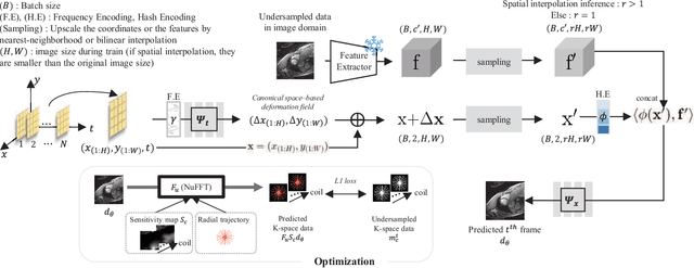 Figure 1 for Dynamic-Aware Spatio-temporal Representation Learning for Dynamic MRI Reconstruction