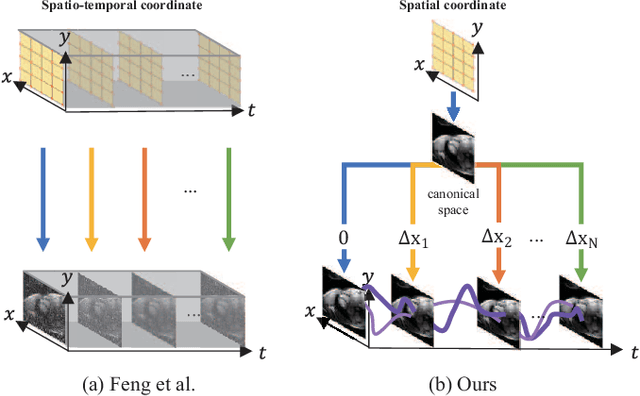 Figure 2 for Dynamic-Aware Spatio-temporal Representation Learning for Dynamic MRI Reconstruction