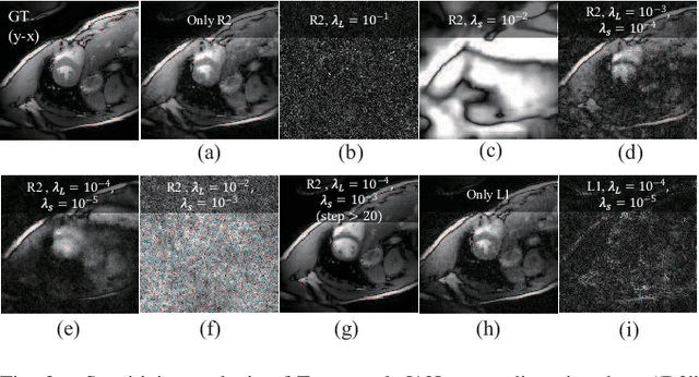 Figure 3 for Dynamic-Aware Spatio-temporal Representation Learning for Dynamic MRI Reconstruction
