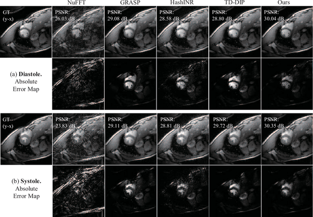 Figure 4 for Dynamic-Aware Spatio-temporal Representation Learning for Dynamic MRI Reconstruction