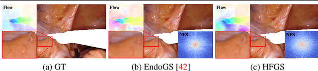 Figure 1 for HFGS: 4D Gaussian Splatting with Emphasis on Spatial and Temporal High-Frequency Components for Endoscopic Scene Reconstruction