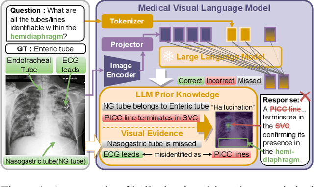Figure 1 for Anatomical Region-Guided Contrastive Decoding: A Plug-and-Play Strategy for Mitigating Hallucinations in Medical VLMs