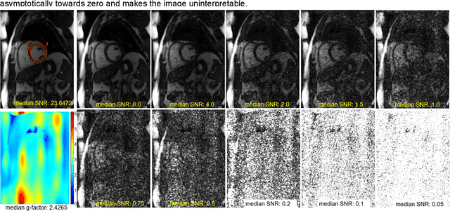 Figure 1 for Imaging Transformer for MRI Denoising: a Scalable Model Architecture that enables SNR << 1 Imaging