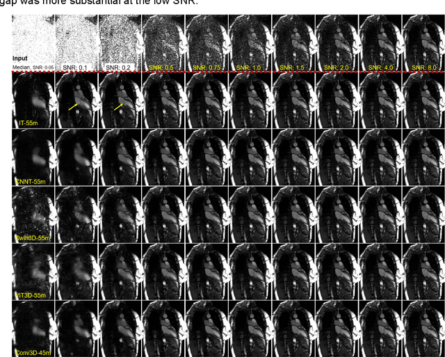 Figure 2 for Imaging Transformer for MRI Denoising: a Scalable Model Architecture that enables SNR << 1 Imaging