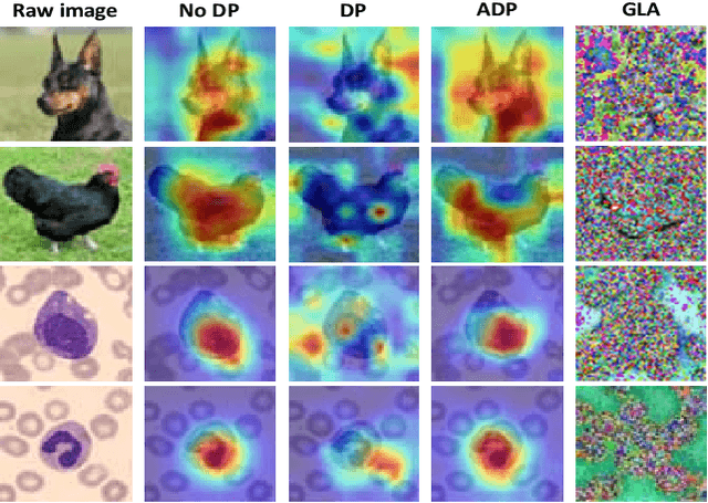 Figure 1 for Balancing Privacy Protection and Interpretability in Federated Learning