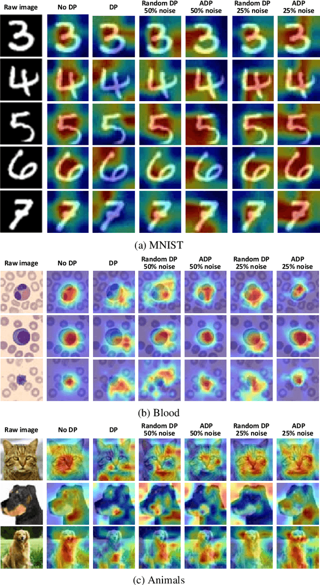 Figure 4 for Balancing Privacy Protection and Interpretability in Federated Learning