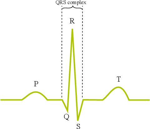 Figure 1 for Leveraging Statistical Shape Priors in GAN-based ECG Synthesis