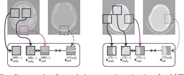 Figure 4 for Unsupervised Skull Segmentation via Contrastive MR-to-CT Modality Translation