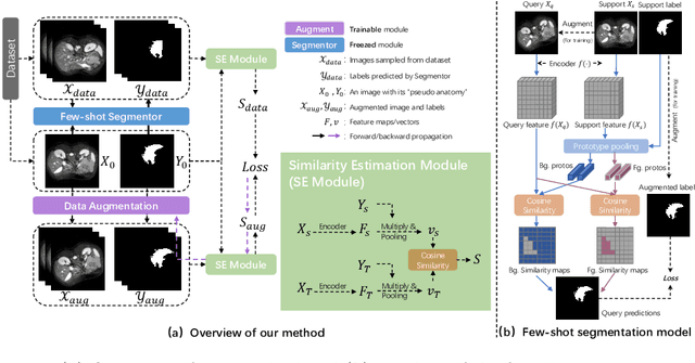 Figure 1 for Unsupervised augmentation optimization for few-shot medical image segmentation