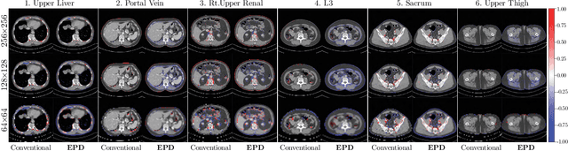 Figure 4 for Towards Efficient and Accurate CT Segmentation via Edge-Preserving Probabilistic Downsampling
