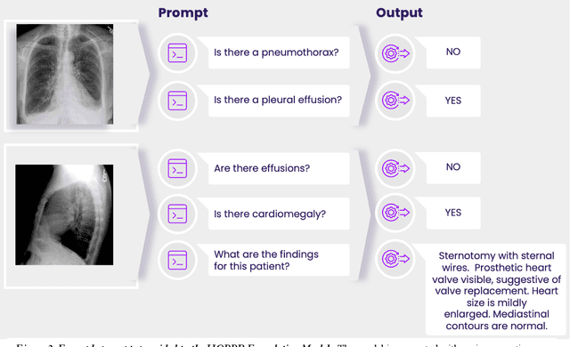 Figure 2 for HOPPR Medical-Grade Platform for Medical Imaging AI