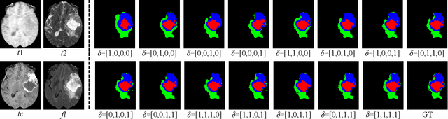 Figure 4 for Decoupling Feature Representations of Ego and Other Modalities for Incomplete Multi-modal Brain Tumor Segmentation