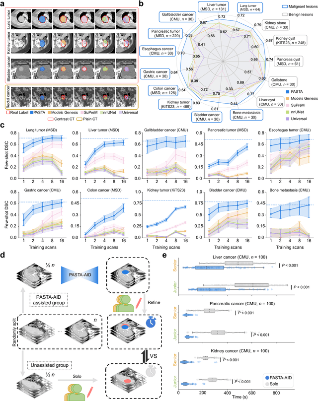 Figure 3 for A Data-Efficient Pan-Tumor Foundation Model for Oncology CT Interpretation