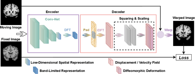 Figure 3 for Fourier-Net: Fast Image Registration with Band-limited Deformation