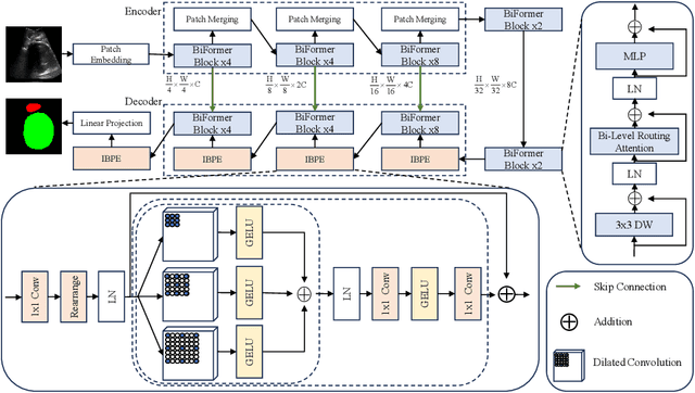 Figure 3 for Pubic Symphysis-Fetal Head Segmentation Network Using BiFormer Attention Mechanism and Multipath Dilated Convolution