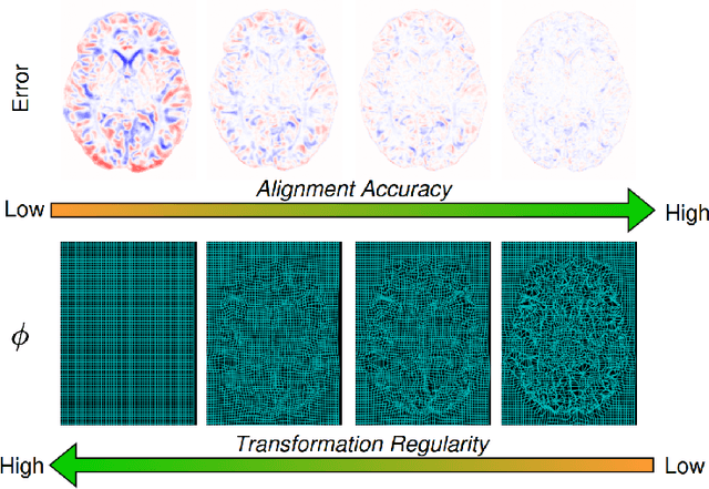 Figure 1 for Evaluation of Alignment-Regularity Characteristics in Deformable Image Registration