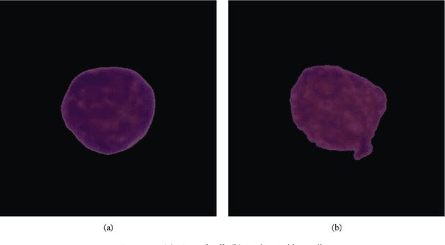Figure 1 for Explainable AI in Diagnosing and Anticipating Leukemia Using Transfer Learning Method