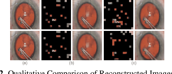 Figure 4 for $\mathsf{CSMAE~}$:~Cataract Surgical Masked Autoencoder (MAE) based Pre-training
