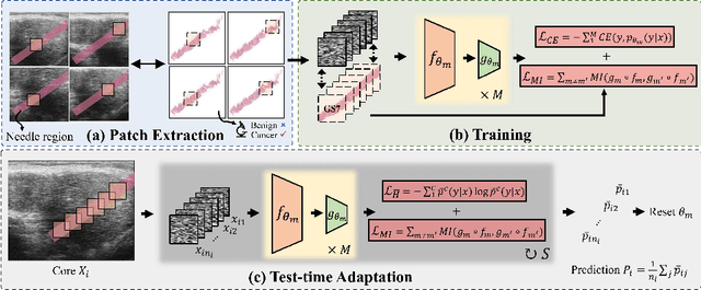 Figure 1 for Calibrated Diverse Ensemble Entropy Minimization for Robust Test-Time Adaptation in Prostate Cancer Detection