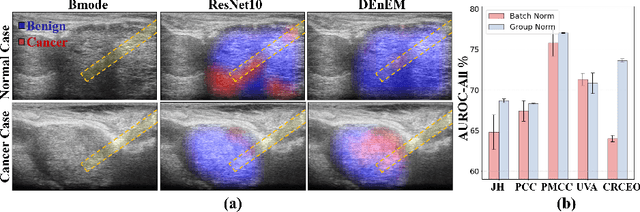 Figure 4 for Calibrated Diverse Ensemble Entropy Minimization for Robust Test-Time Adaptation in Prostate Cancer Detection