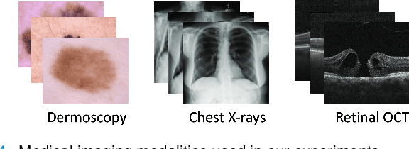 Figure 4 for Improving Learning of New Diseases through Knowledge-Enhanced Initialization for Federated Adapter Tuning