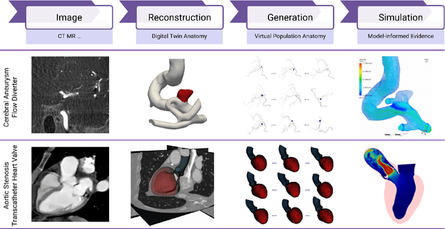 Figure 1 for From Pixels to Polygons: A Survey of Deep Learning Approaches for Medical Image-to-Mesh Reconstruction