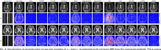 Figure 4 for UPMRI: Unsupervised Parallel MRI Reconstruction via Projected Conditional Flow Matching